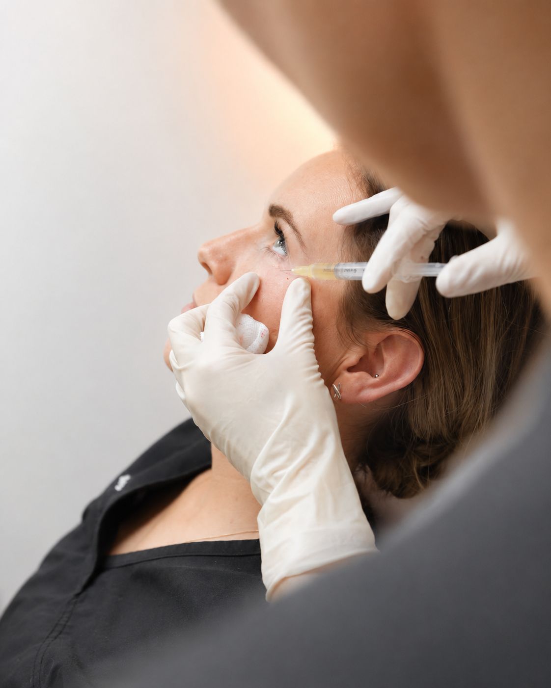 Plasma Rico en Plaquetas (PRP)